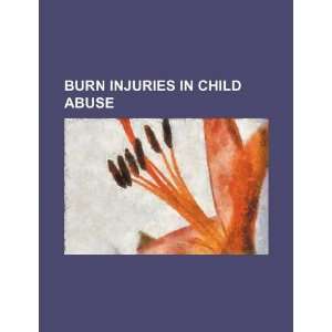  Burn injuries in child abuse (9781234248062) U.S 