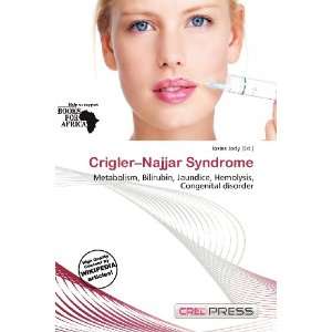    Crigler Najjar Syndrome (9786200833990) Iosias Jody Books