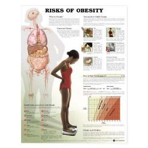  Risks of Obesity Chart Industrial & Scientific