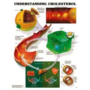  Lww Understanding Cholesterol Anatomical Chart Laminated (In Stock 