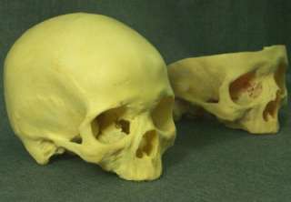 TWO real antique human skulls. Medical teaching aid. Estate sale. No 